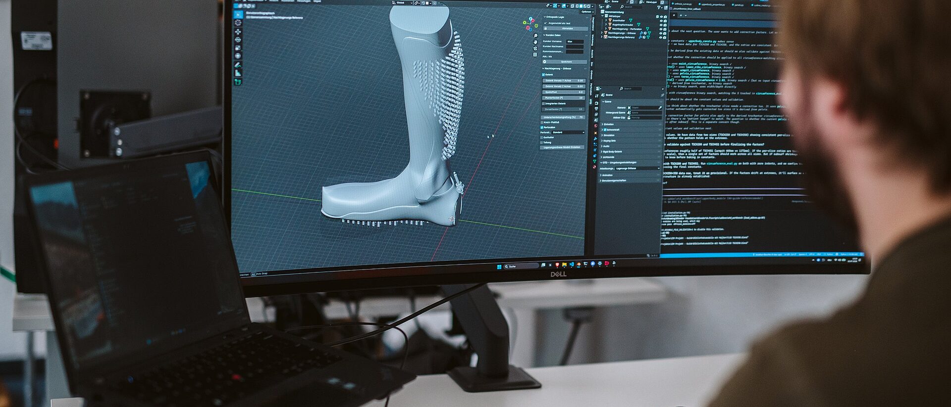CAD-Konstruktion einer Orthese am Bildschirm